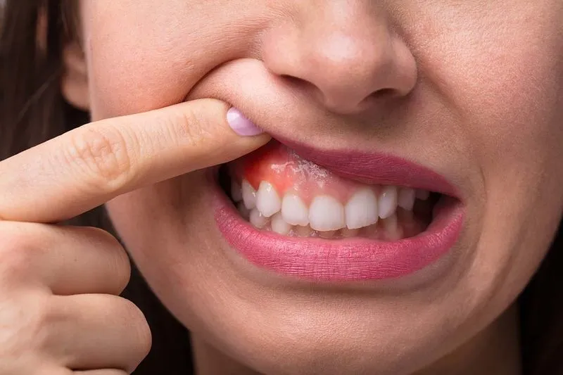 Как вылечить зубную боль