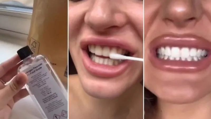 Как отбелить зубы содой