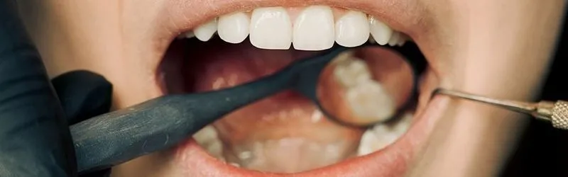 Как избавиться от боли в зубе