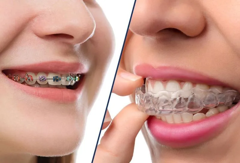 Чем ортодонт отличается от стоматолога