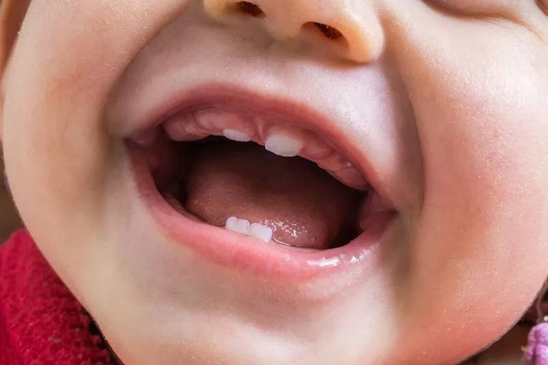 Как растут зубы у детей