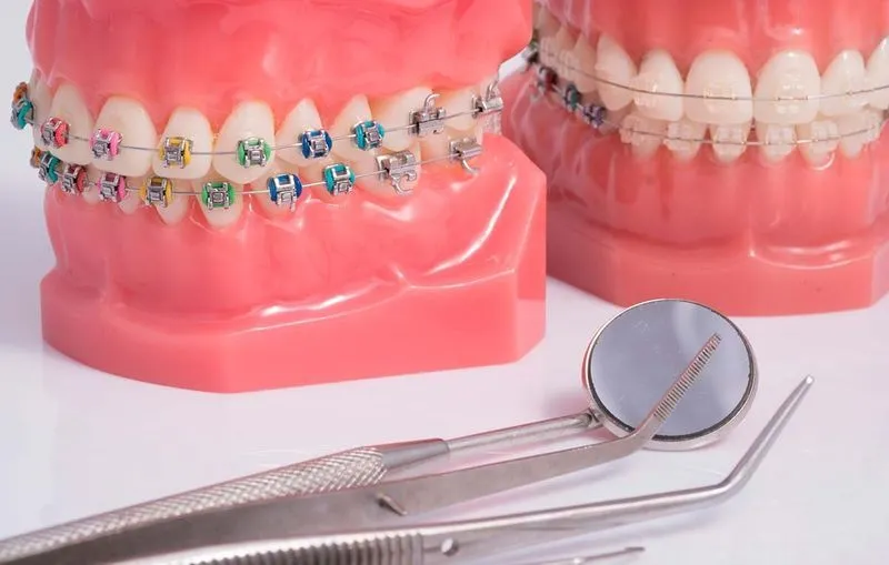 Что такое ортодонтия