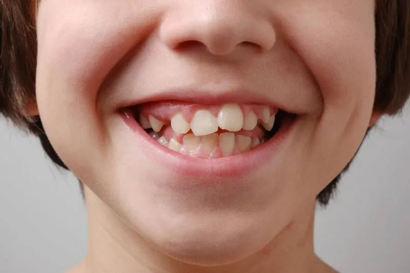 Какие зубы не меняются у человека