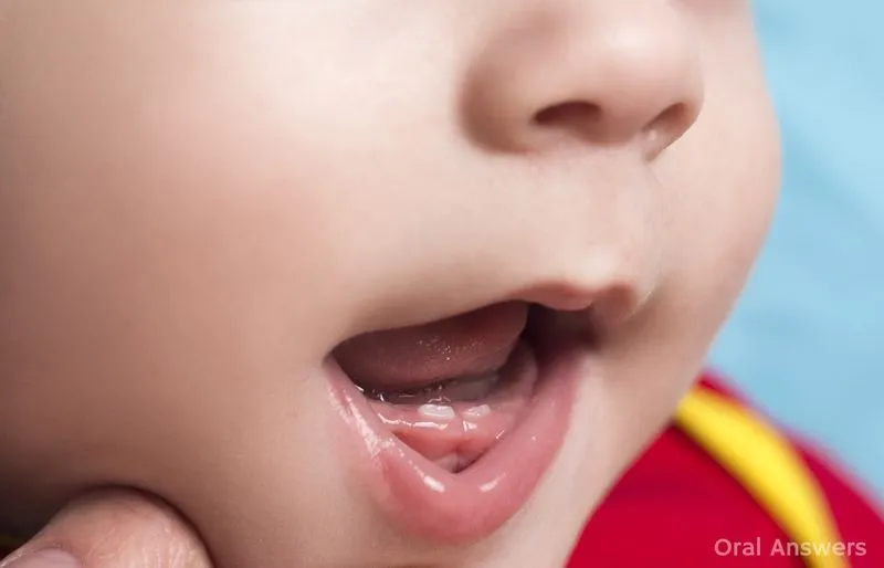 Режется зуб у ребенка