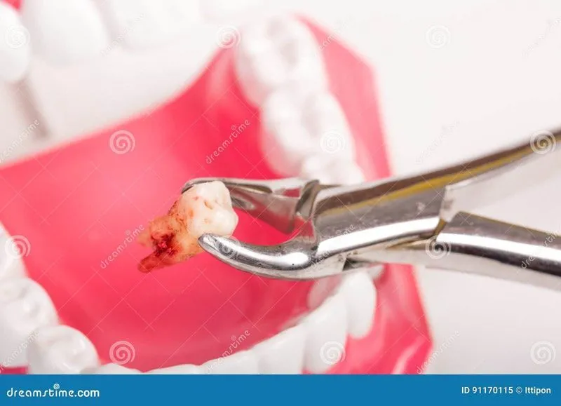 Вырвать зуб самостоятельно