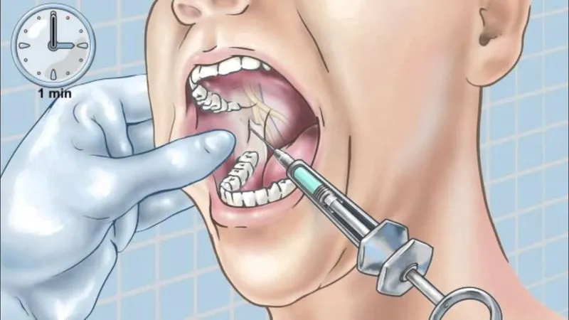 При флюсе удаляют зуб