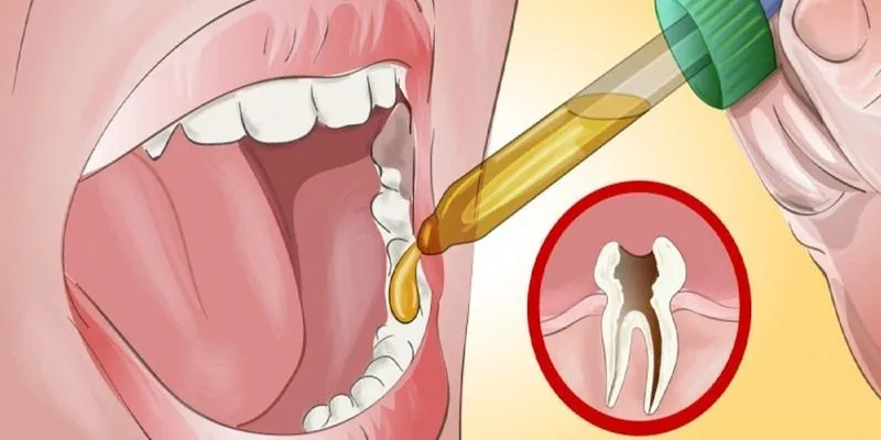 Народные средства зубная боль