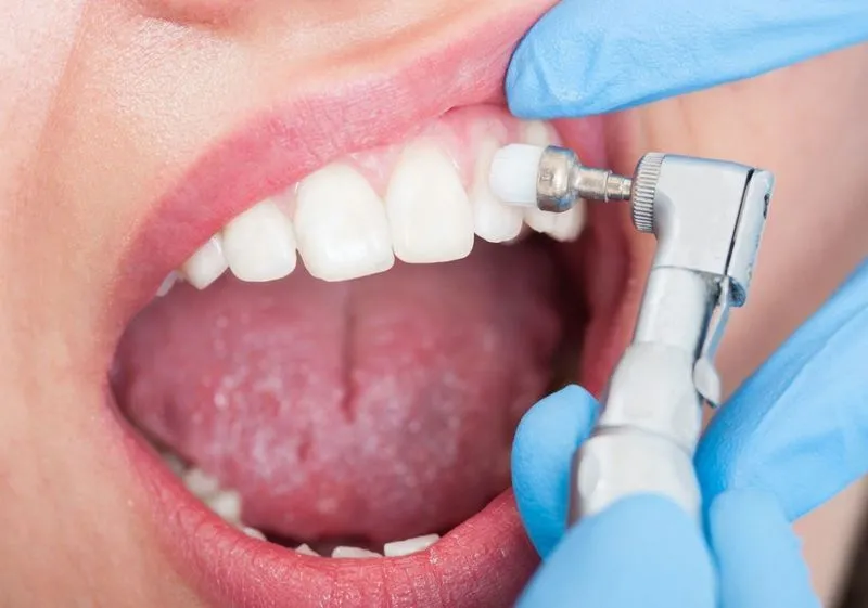 Чистить зубы после удаления зуба